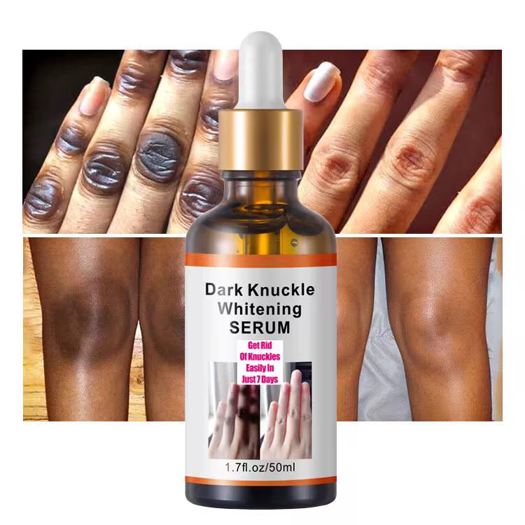 Sérum Anti Taches Noires Kinto